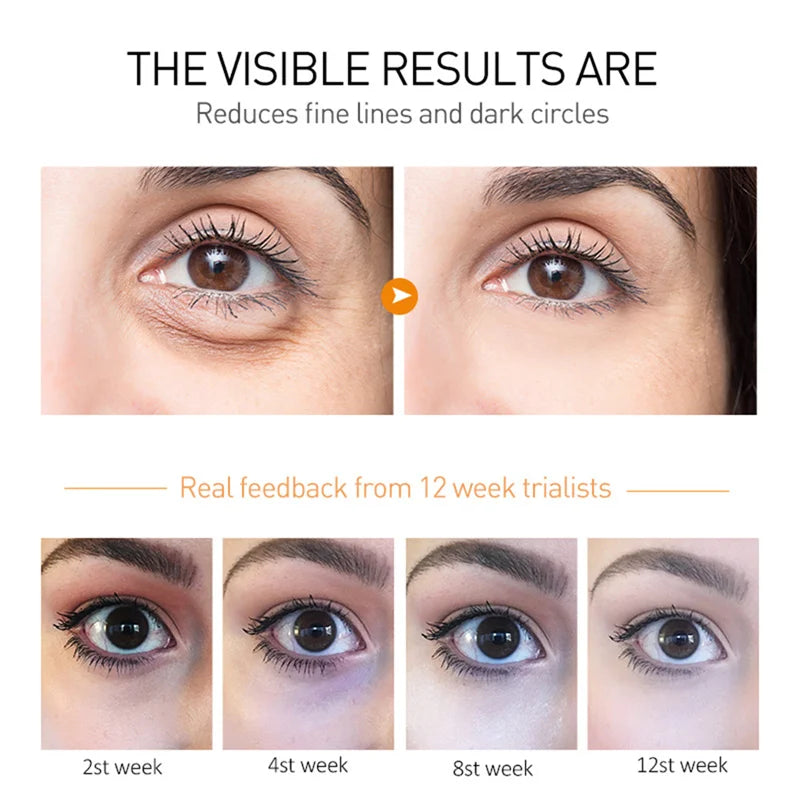 Eelhoe Avocado Infused Anti-Wrinkle Eye Cream